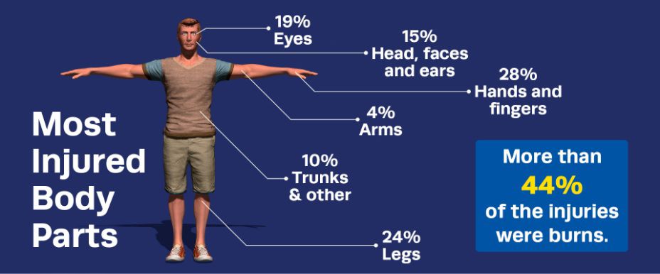 fireworks injuries